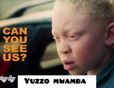 Yuzzo Mwamba Story Ya Albino