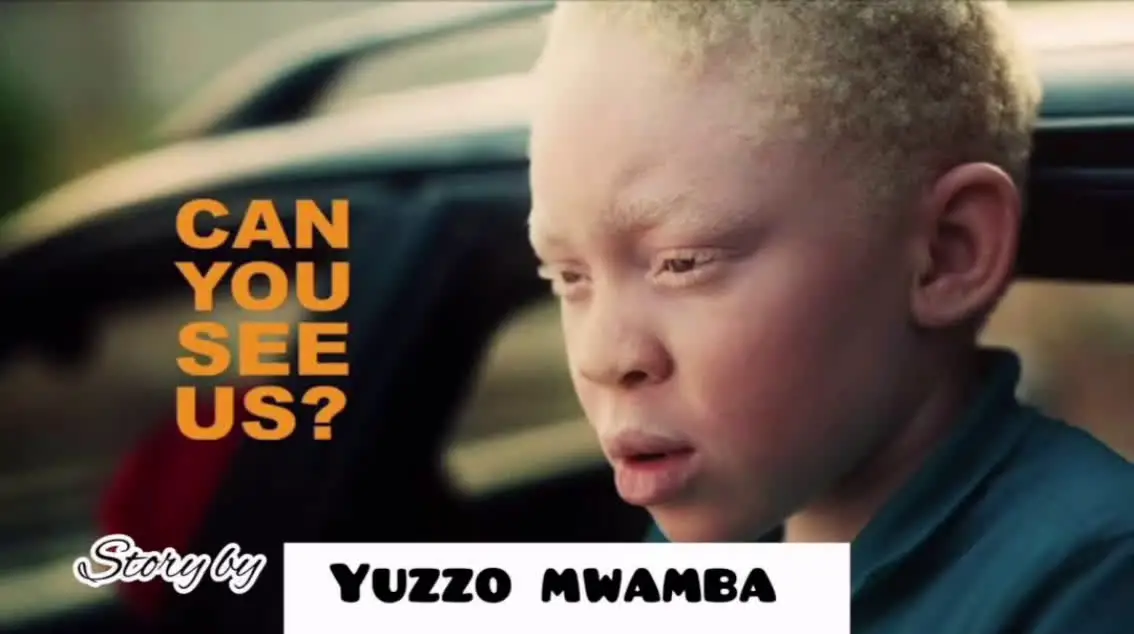 yuzzo mwamba - story ya albino Yuzzo Mwamba Story Ya Albino